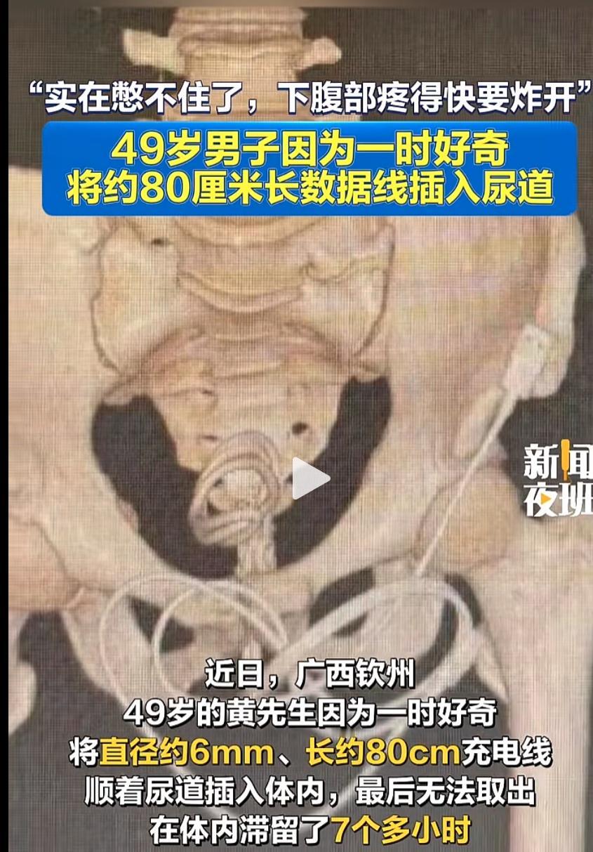 赛博格一集 ​​​
