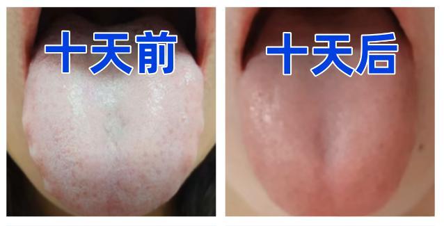 今天周末时间充裕！继续给大家看舌，不管有多少人，我都会一对一详细分析，不绕弯子，