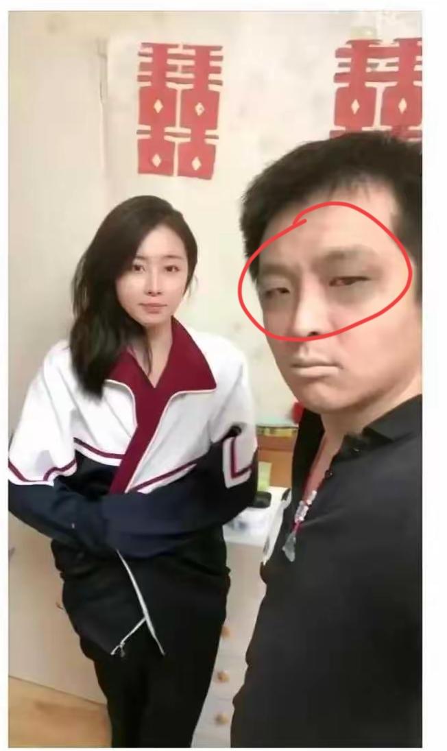 小伙子年轻也不能这么折腾，刚刚新婚就把自己折腾成这样子，看你这个眼神生不可恋。