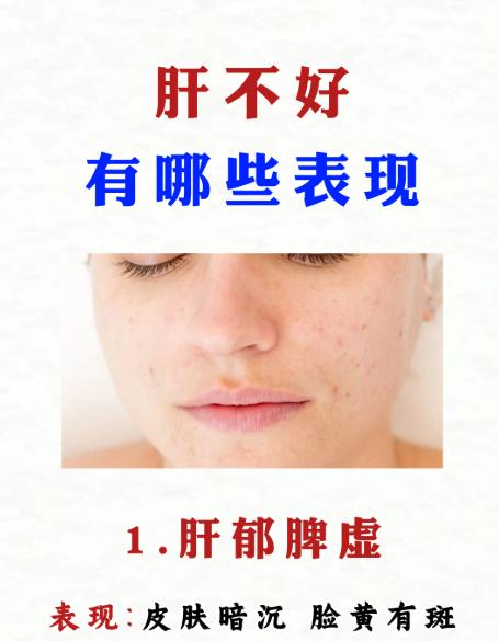 肝失调的常见表现有哪些