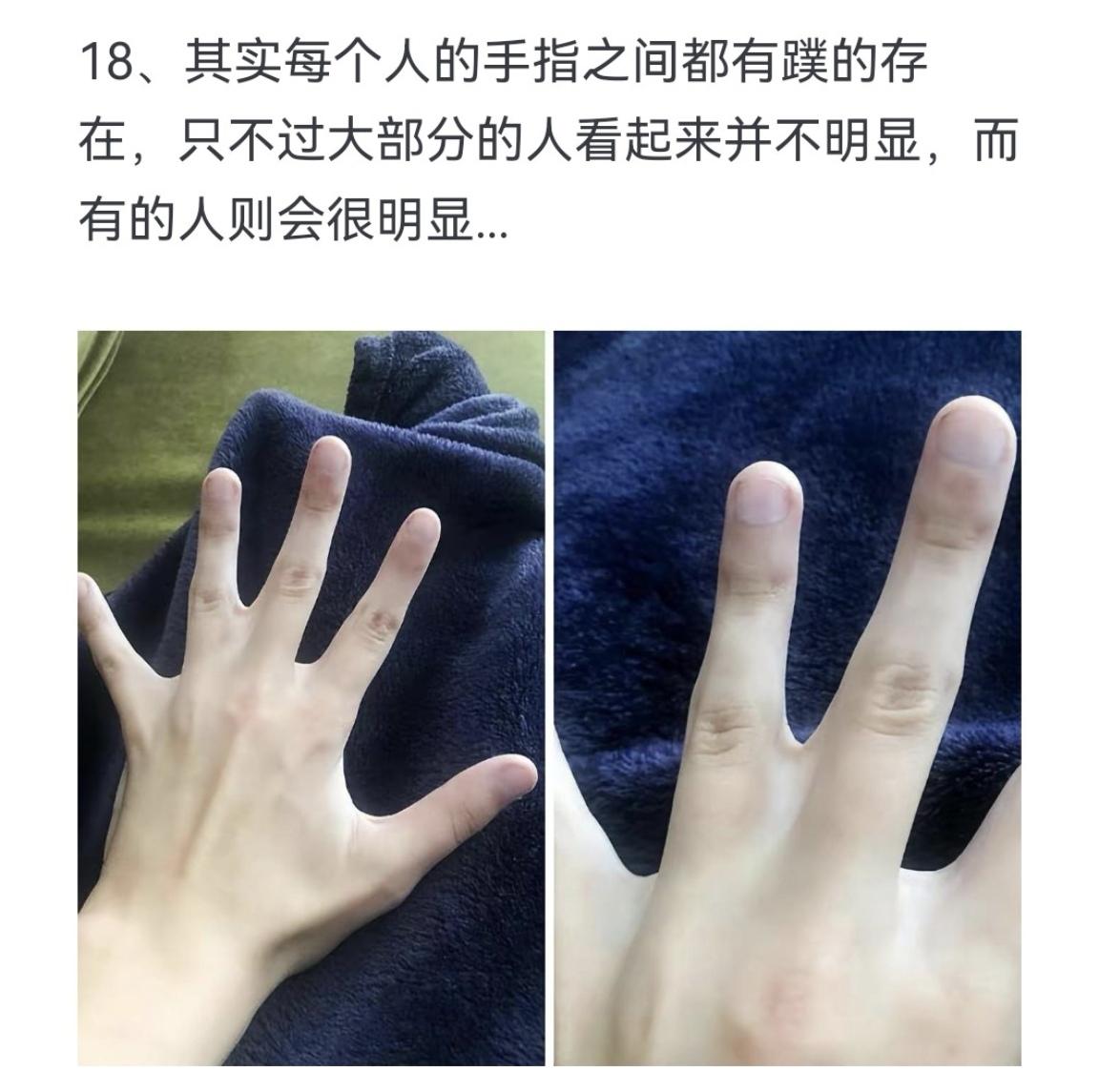 其实每个人的手指之间都有蹼的存在，只不过大部分的人看起来并不明显，而有...