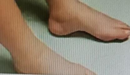 中老年人下肢水肿可愁人了，不过有几个简单方法能试试。
抬高下肢就挺管用。晚上睡觉