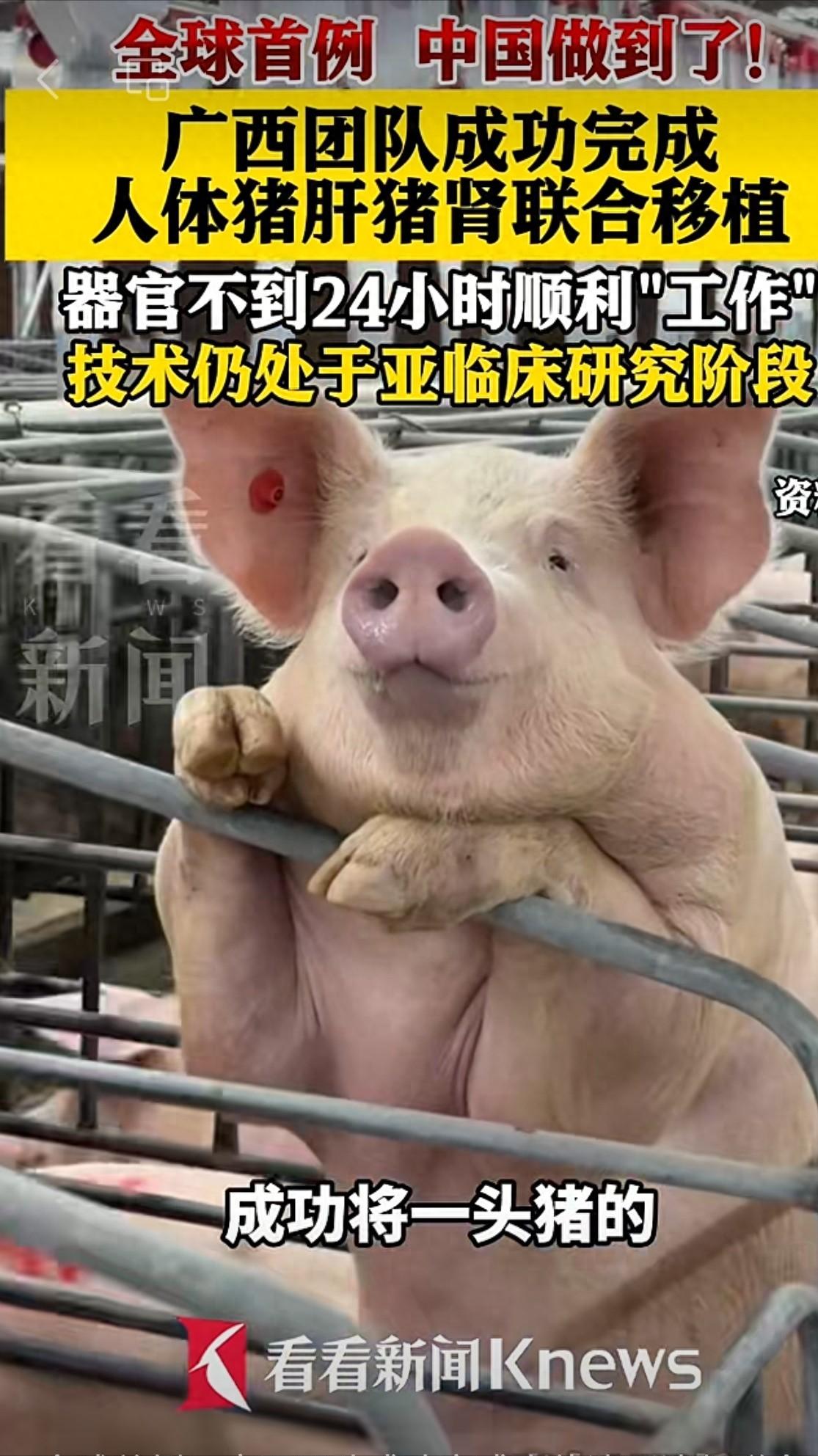 全球首例！6月1日报道，广西一帮医生，居然把一整头猪的肝脏，连同两颗猪腰子，一次