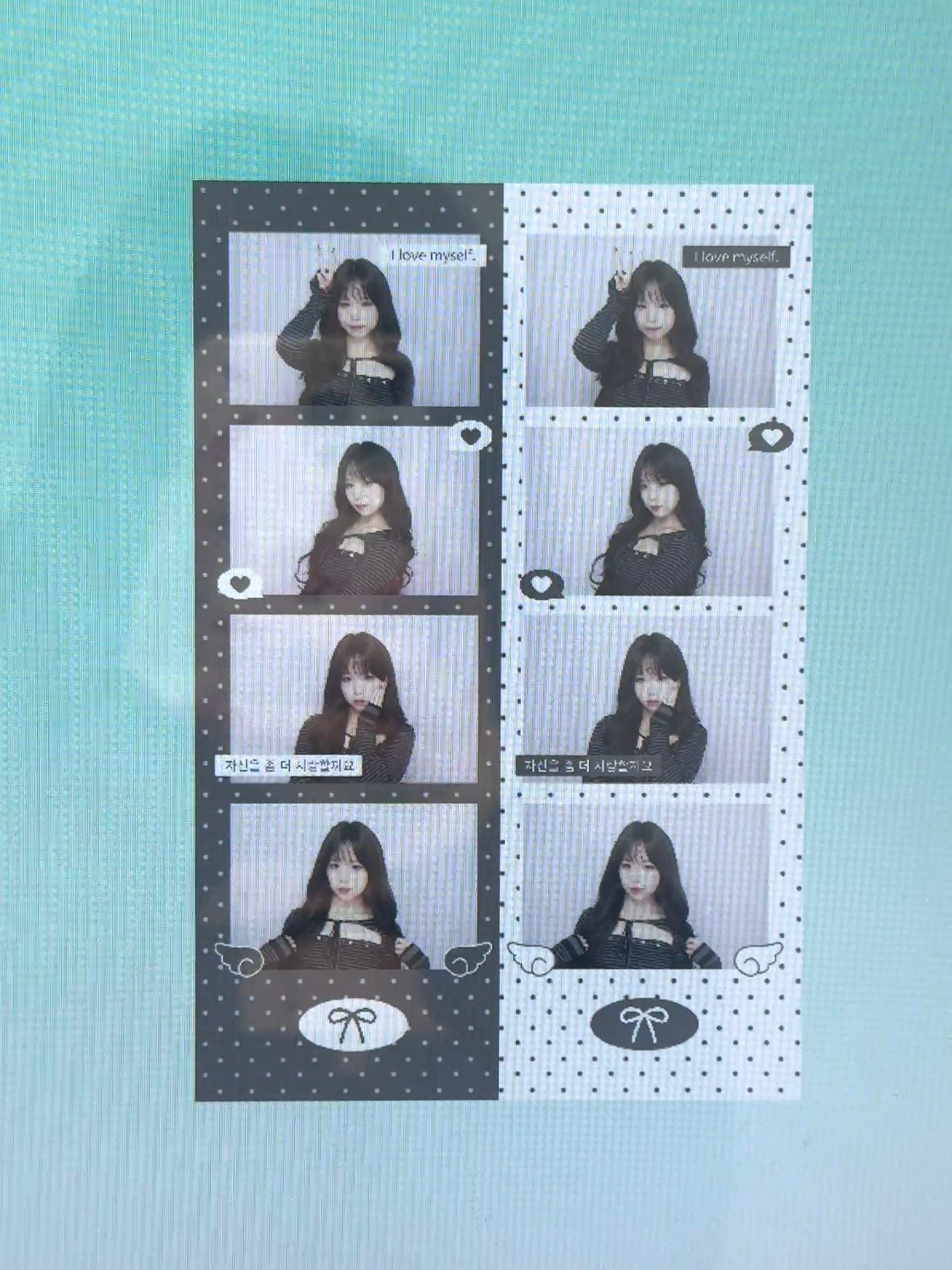 为什么我下巴后缩为什么我下巴后缩为什么我口呼吸矫正不了下巴后缩 