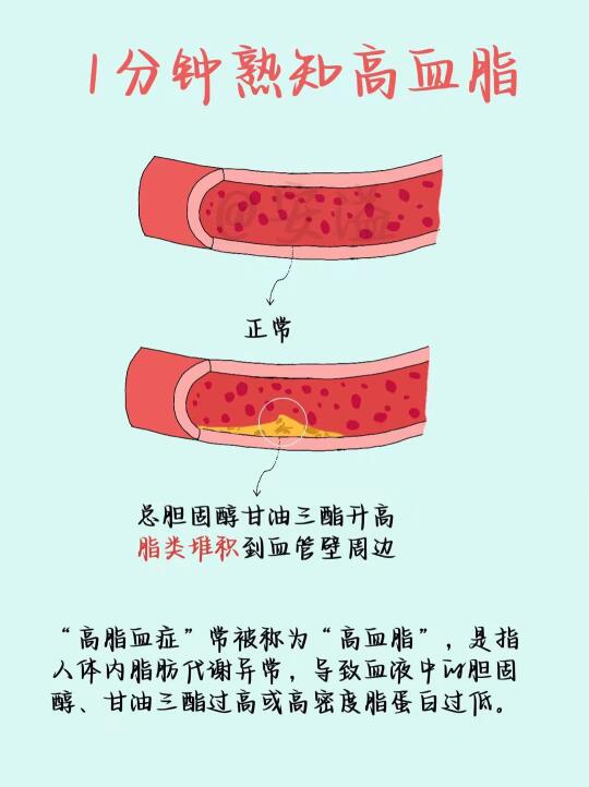 🔥刷到就是赚到！1分钟了解高血脂