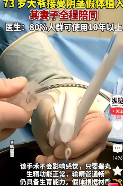 73岁男子为比自己小30多岁的妻子改善夫妻生活，主动接受阴茎假体植入手术，不少网