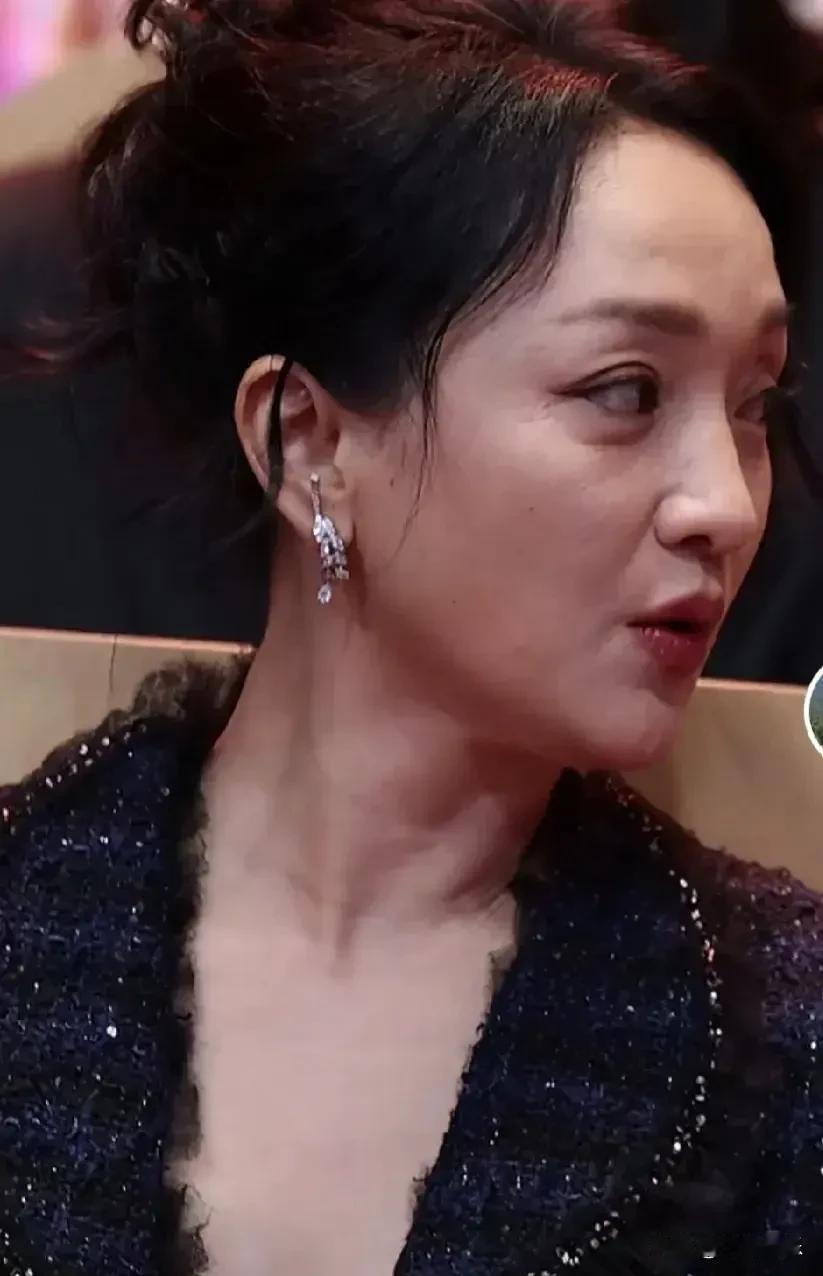 抽烟对皮肤不好，你看周迅就明白了！年轻的时候还好说，毕竟优势强大，对皮肤的伤害可
