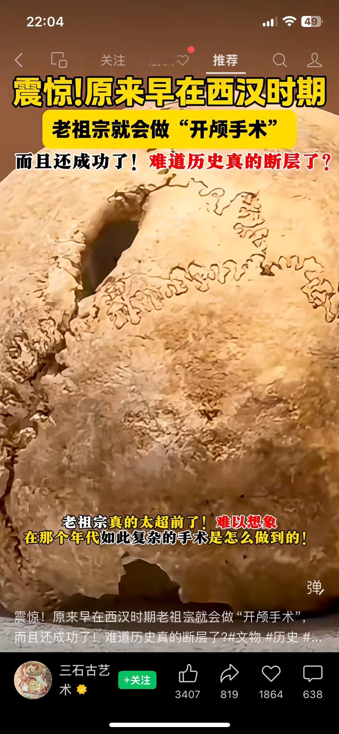 两千年前古墓出土头骨！古人的医疗水平真的被低估了
（信息来源：北京市考古研究院）