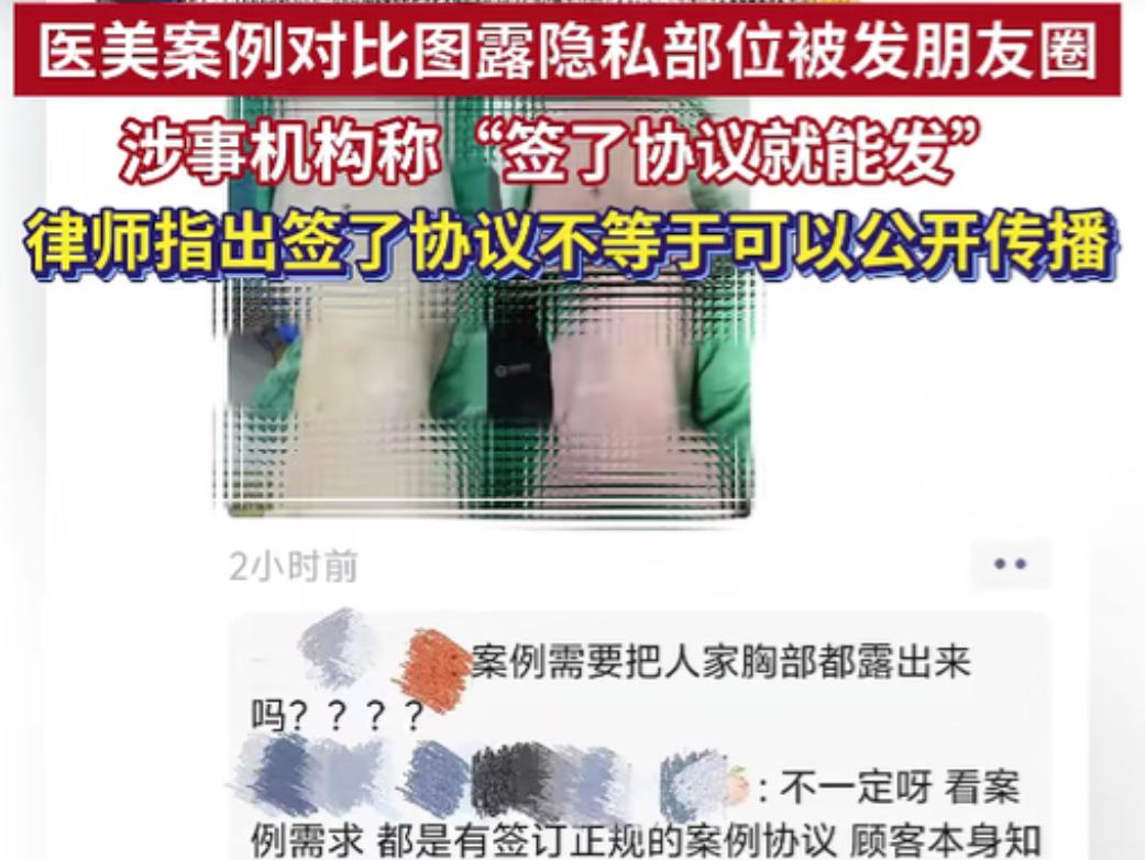 重庆一女子刷到医美朋友的朋友圈，腹部项目露出顾客胸部，乳头、乳晕都很清楚，一点遮
