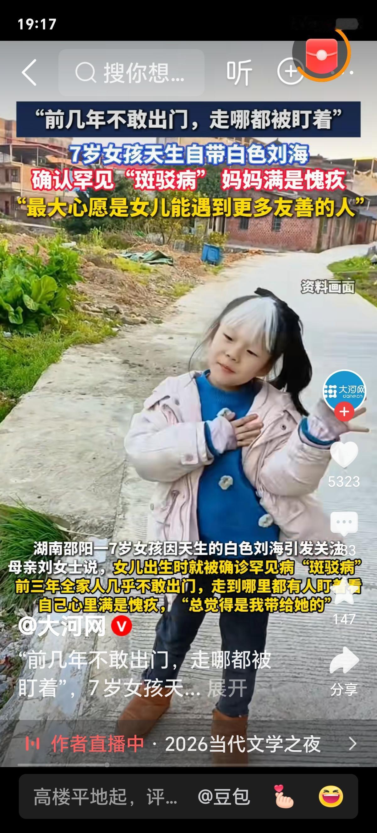 7岁女孩天生白色刘海，确诊罕见病“斑驳病”
 
谁能想到，一个年仅七岁的小女孩，