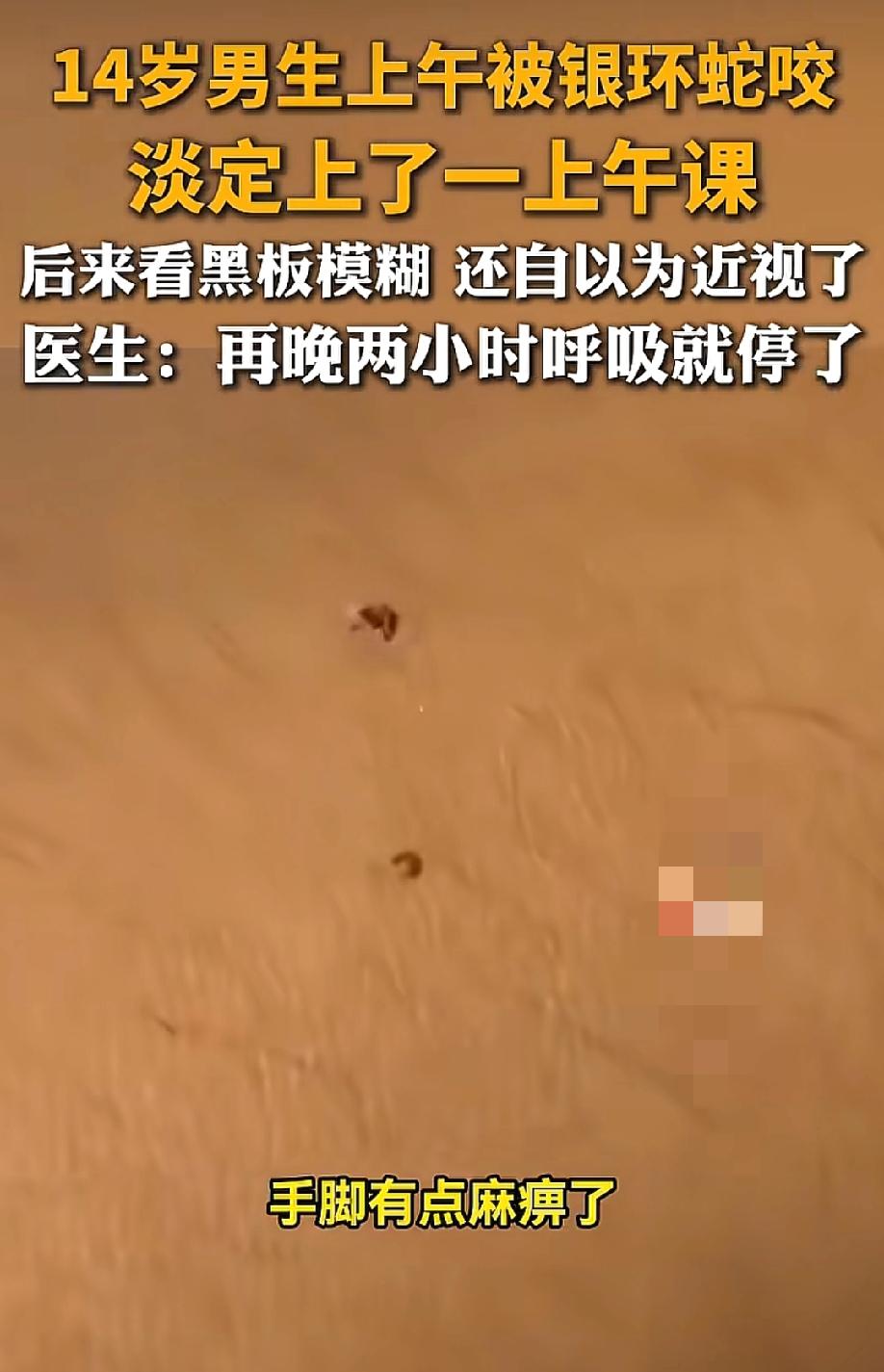 这心态真稳啊！被银环蛇咬了，看不清东西还以为是近视，14岁男孩淡定上完两节课才去