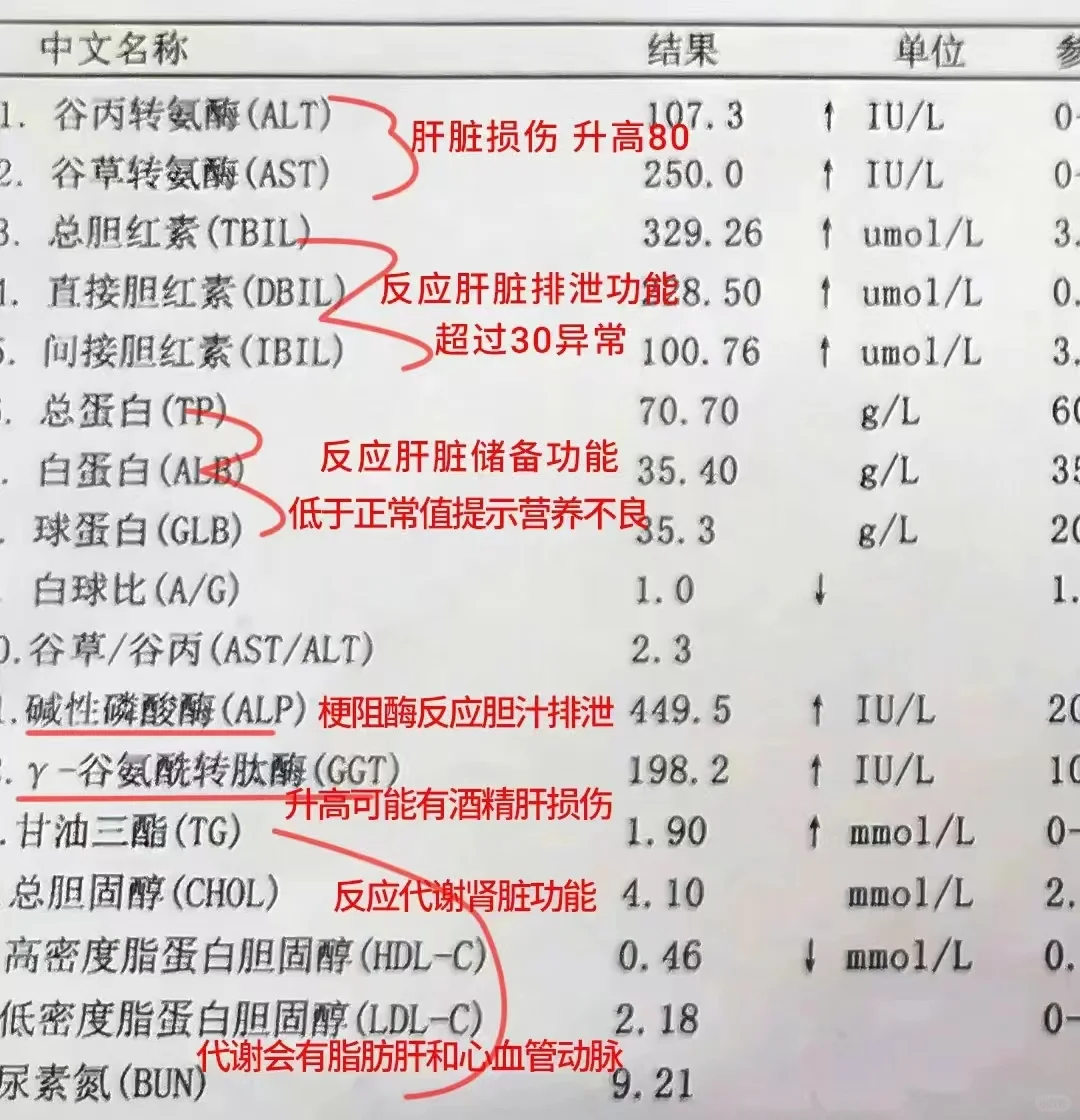 肝病医生教你看懂肝功能化验单！