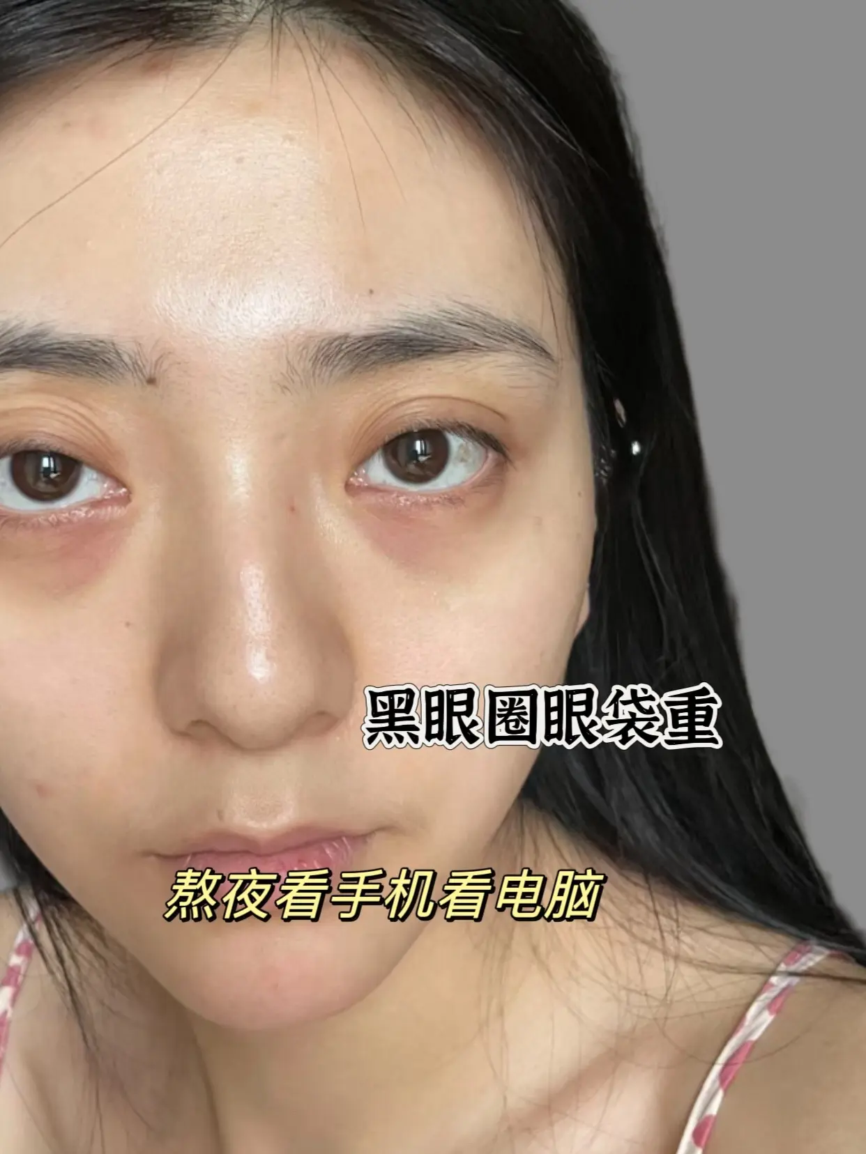除黑眼圈眼袋细纹用眼膜贴。姐妹们现在有黑眼圈眼袋都是用眼膜贴贴，晚上贴...