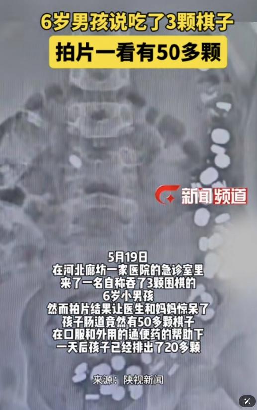 万万没有想到，河北廊坊，一名6岁男孩玩着玩着，突然告诉妈妈自己吞了3颗棋子下肚，
