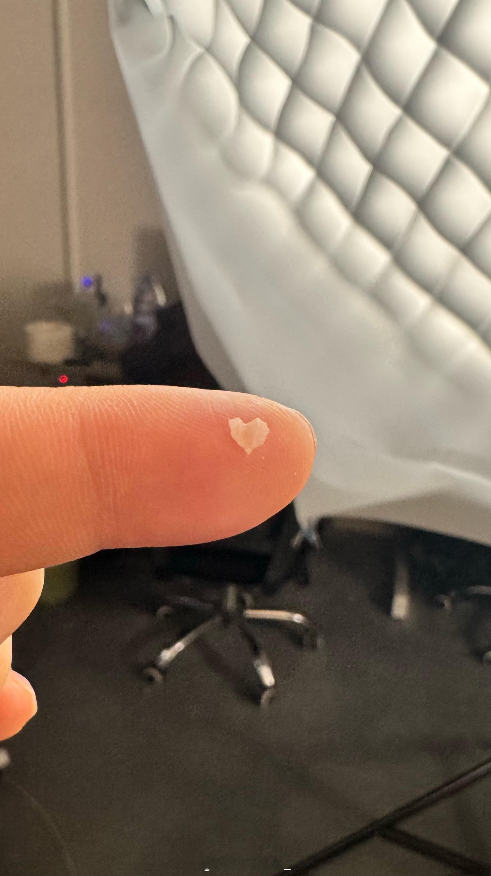 之前用夹板烫彩带烫伤的地方好了然后掉皮了，刚好掉了个❤️