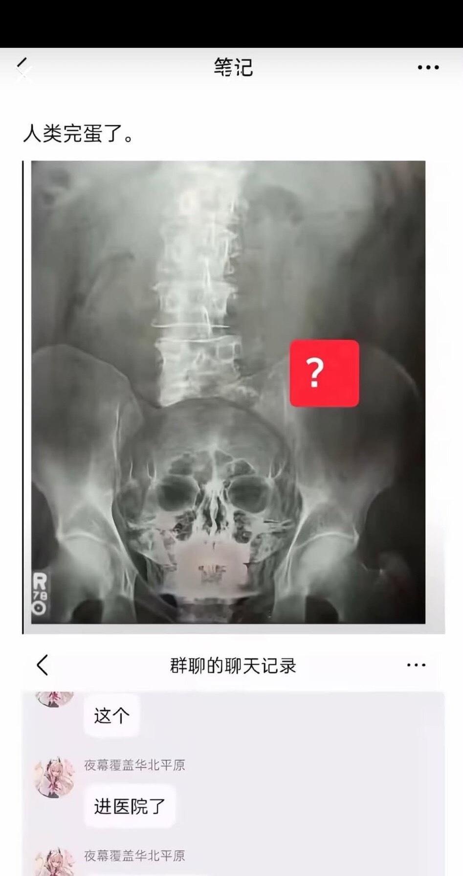 [傻眼]真的假的啊 ​​​