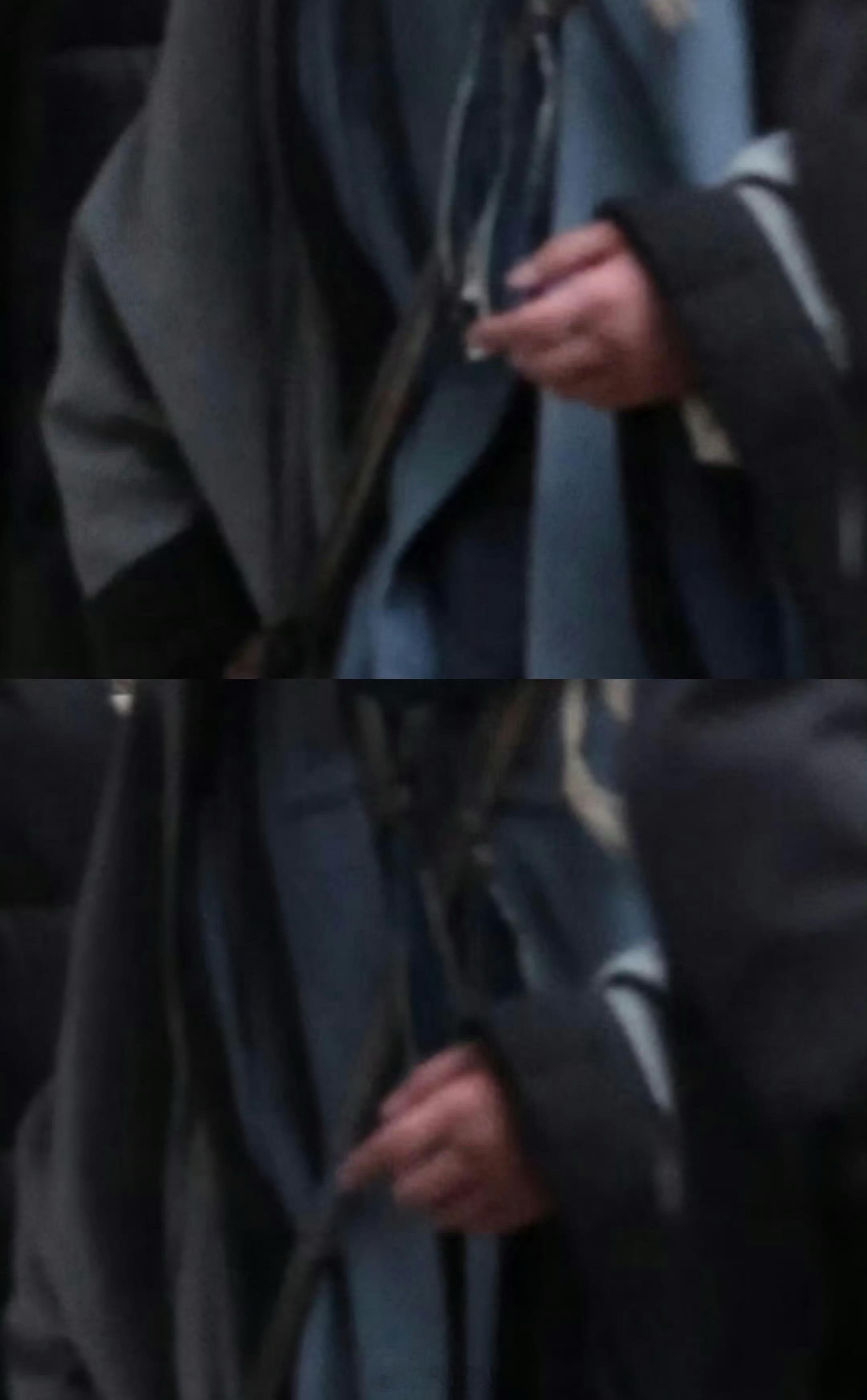 杨洋手好肿杨洋带伤开拍 杨洋带伤开拍不让江山，手还是好肿啊