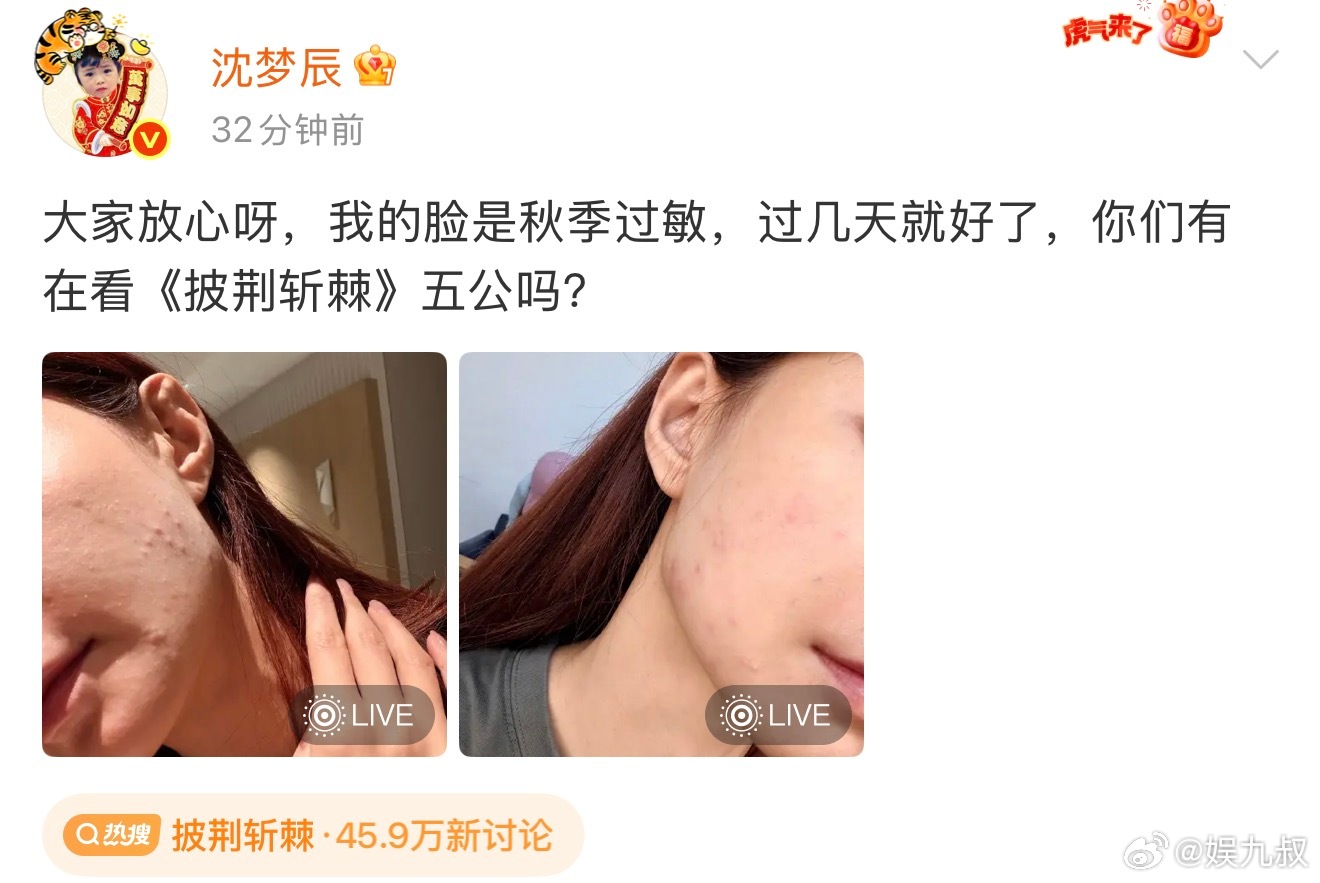 沈梦辰回应烂脸早点好起来呀，过敏真的太可恶了[泪] ​​​