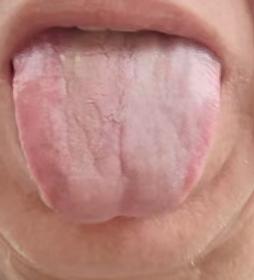 气血瘀堵容易影响海绵体状态，科学疏通经络气血，慢慢恢复机体活力






很多