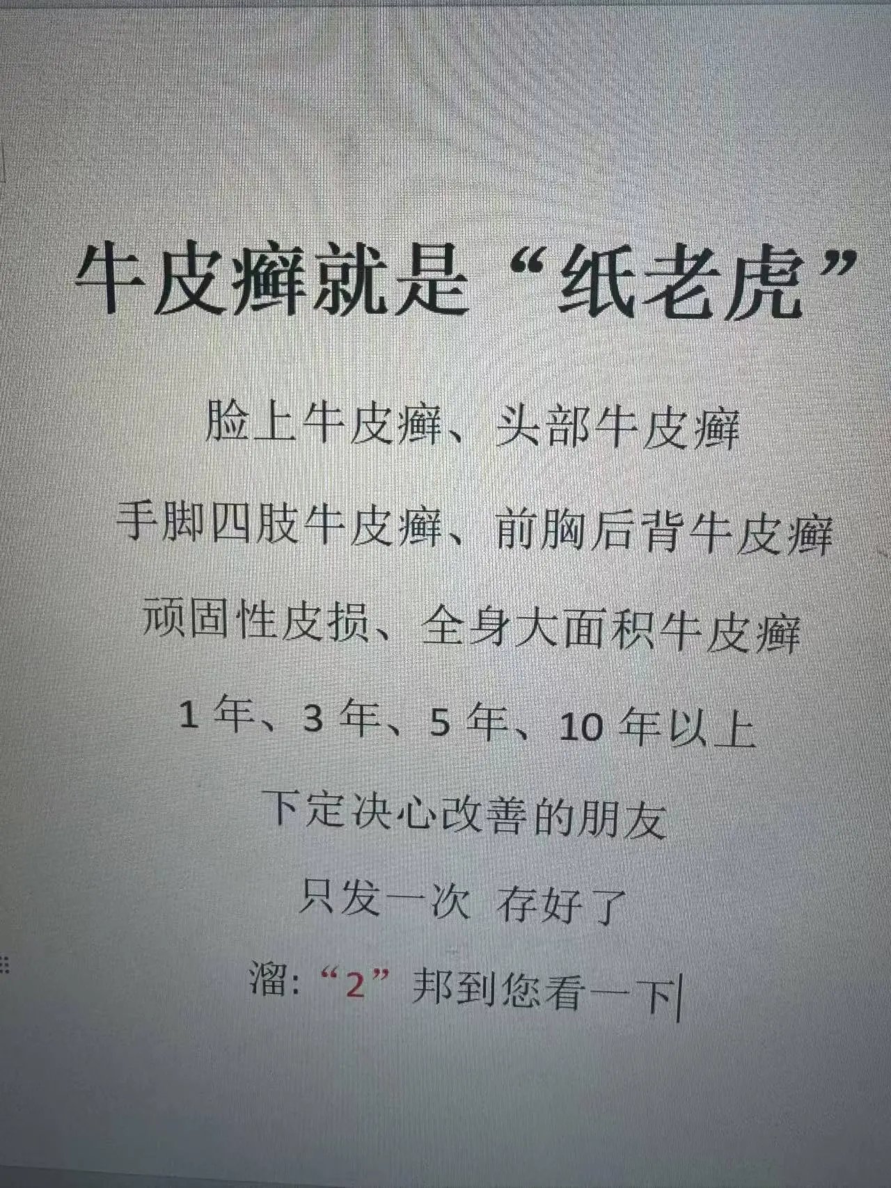 牛皮癣 银屑病 银屑病患者