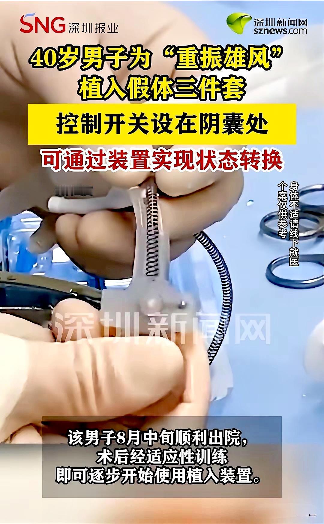 深圳，一名40岁男子看着妻子渴望的眼神，直接让医生给他植入假体三件套。

有了这