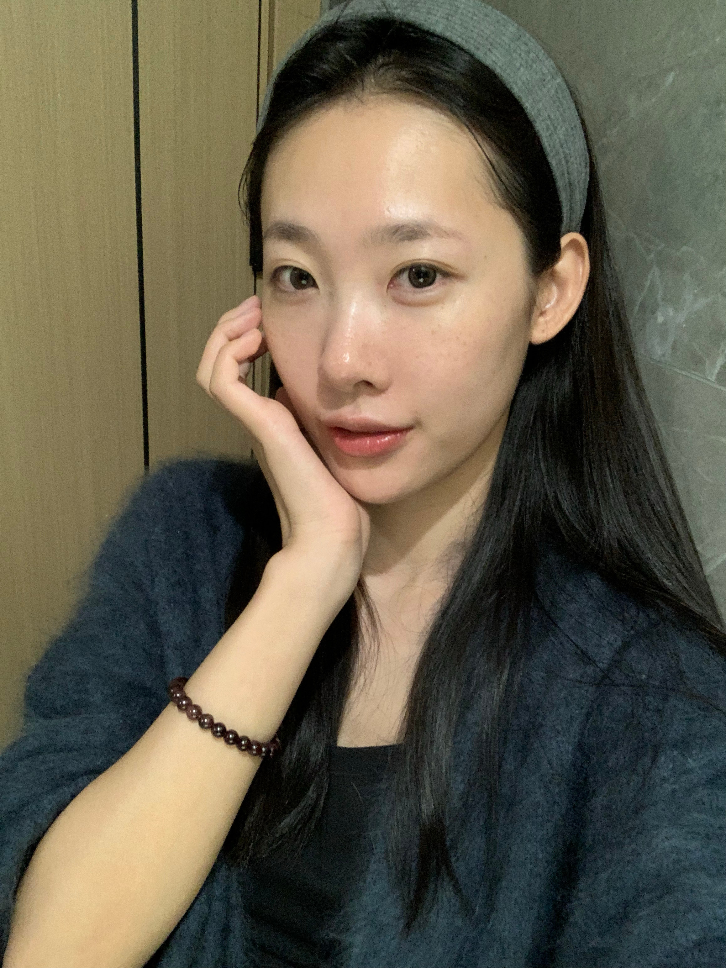 好的 再次相信科技的力量[拜拜]时隔半年做的光电项目onda 做完维护一周的效果