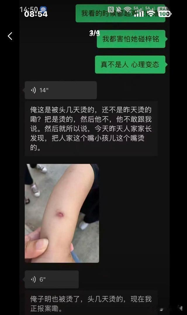 前两天我就觉得这个用热熔胶烫4岁小女孩嘴的女人，不像是偶然的，果然看到又有这个班
