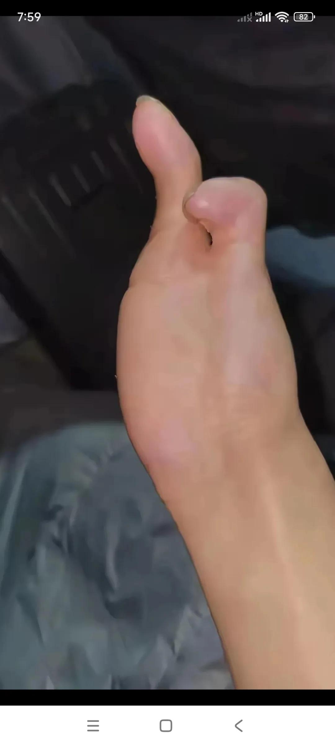 现在的小魏大方了。

过去看小魏的视频，很少能看见小魏把他那个右手露在外边。
