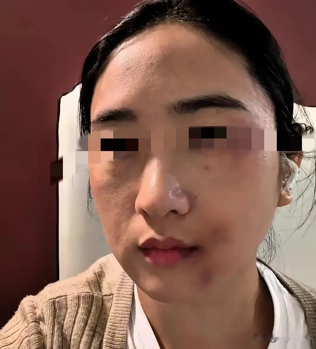 邻居王姐被家暴十几年，前天终于爆发了，她问初中儿子“你爸再打我你帮谁”，儿子头都
