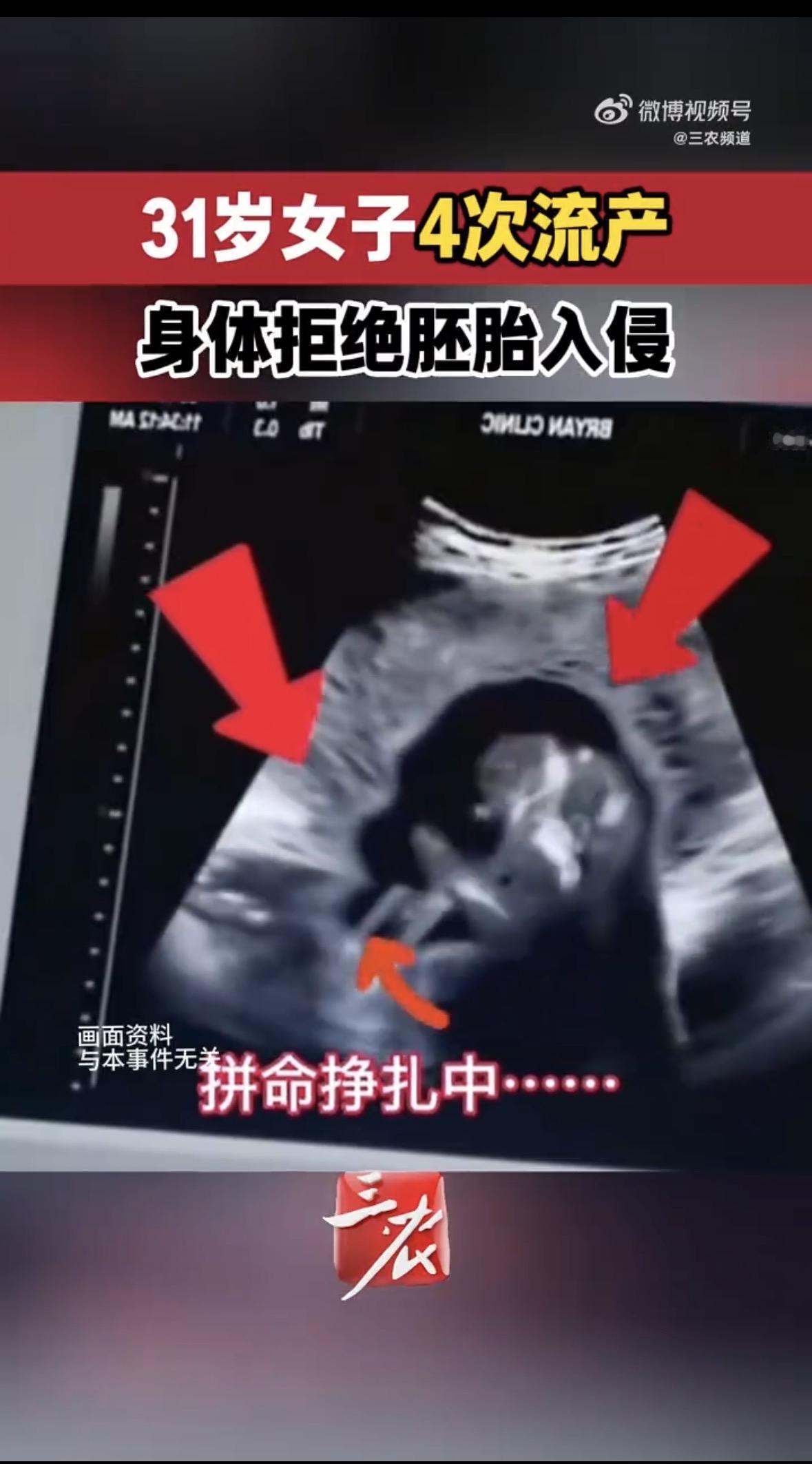 一个女人的身体，竟然会把自己的孩子当作“入侵者”拼命攻击？整整8年，4次怀孕，4