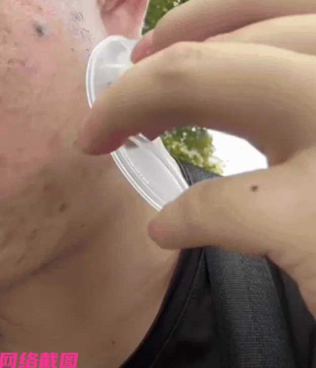 广东有男子身存独特个性，他与蚊子较上劲了，因为蚊子咬他，他不下手拍死而是直接收集