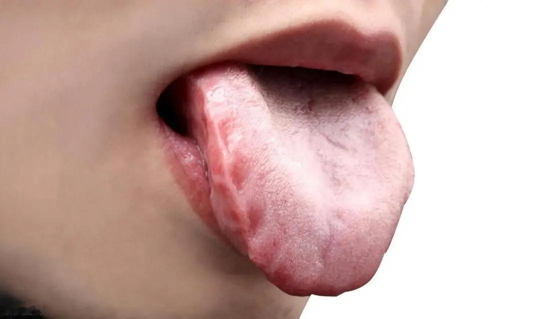 喝水也胖？四招促代谢，告别肚腩烦恼
医生的解答非常详细且专业，针对您提出的减肥难