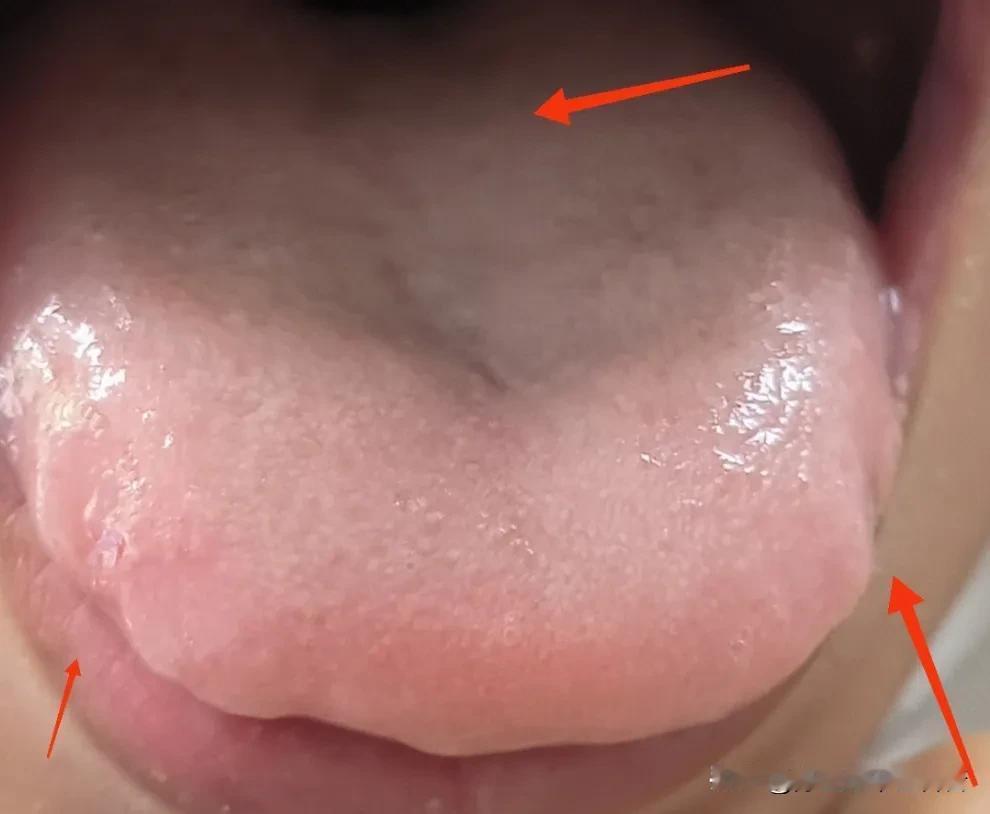 舌中凹陷=中气不足！脾胃枢纽失力，身体这些信号早提醒
 
大家好，我是陈大夫！