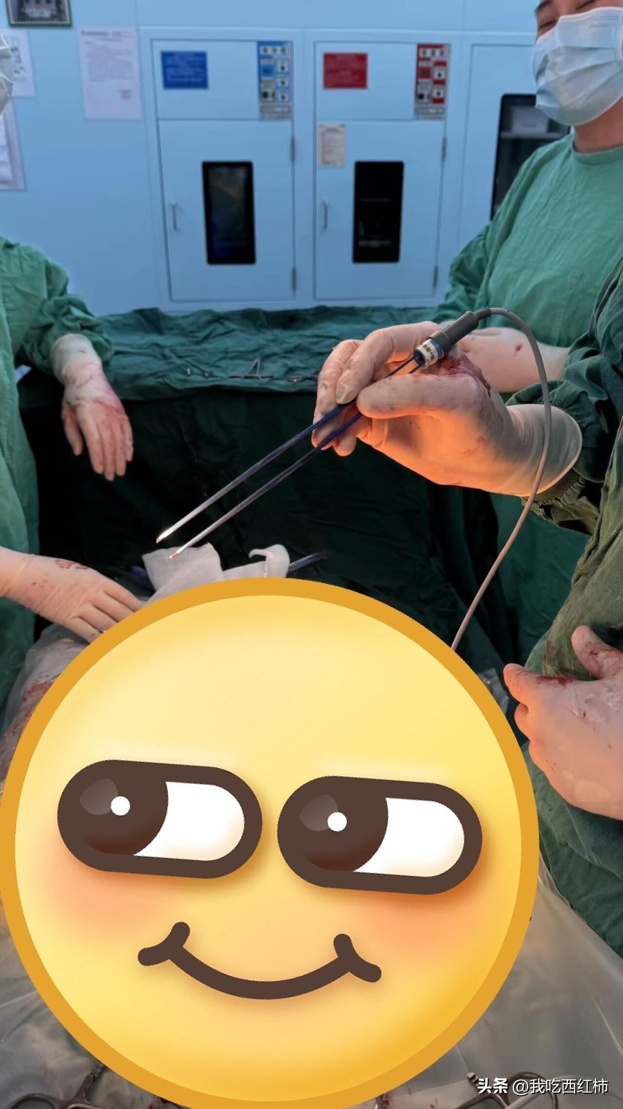 当剖宫产碰到戴牙箍产妇，只能用非常手段了
半夜起来开一个宫口开全两个多小时的产妇