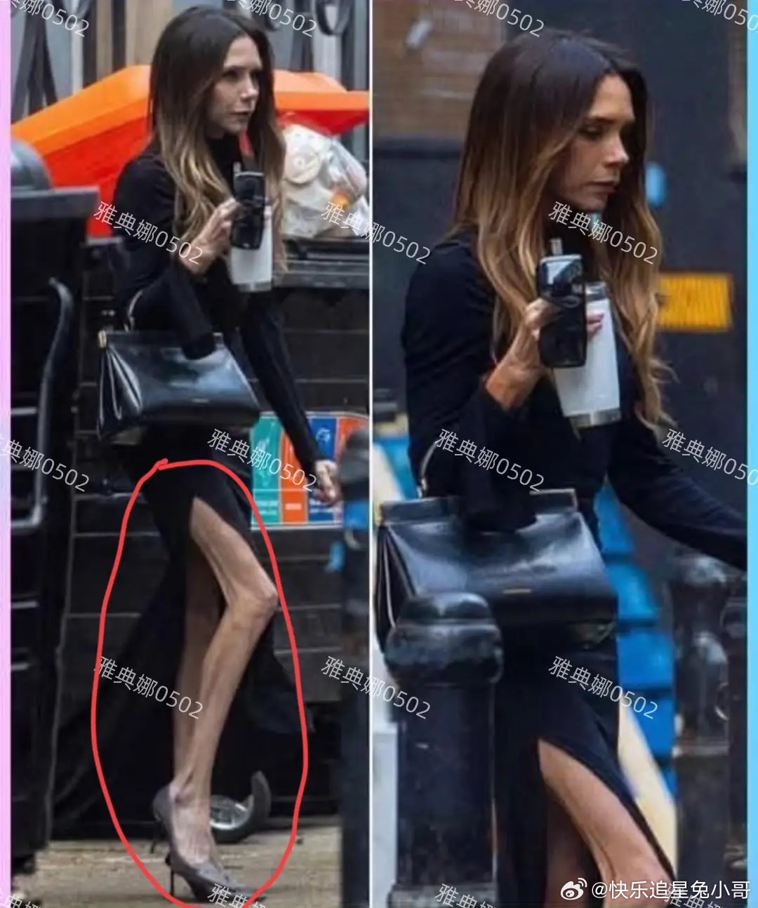 贝克汉姆老婆维多利亚太瘦了，不仅手青筋凸起腿更是只剩一把骨头！ 