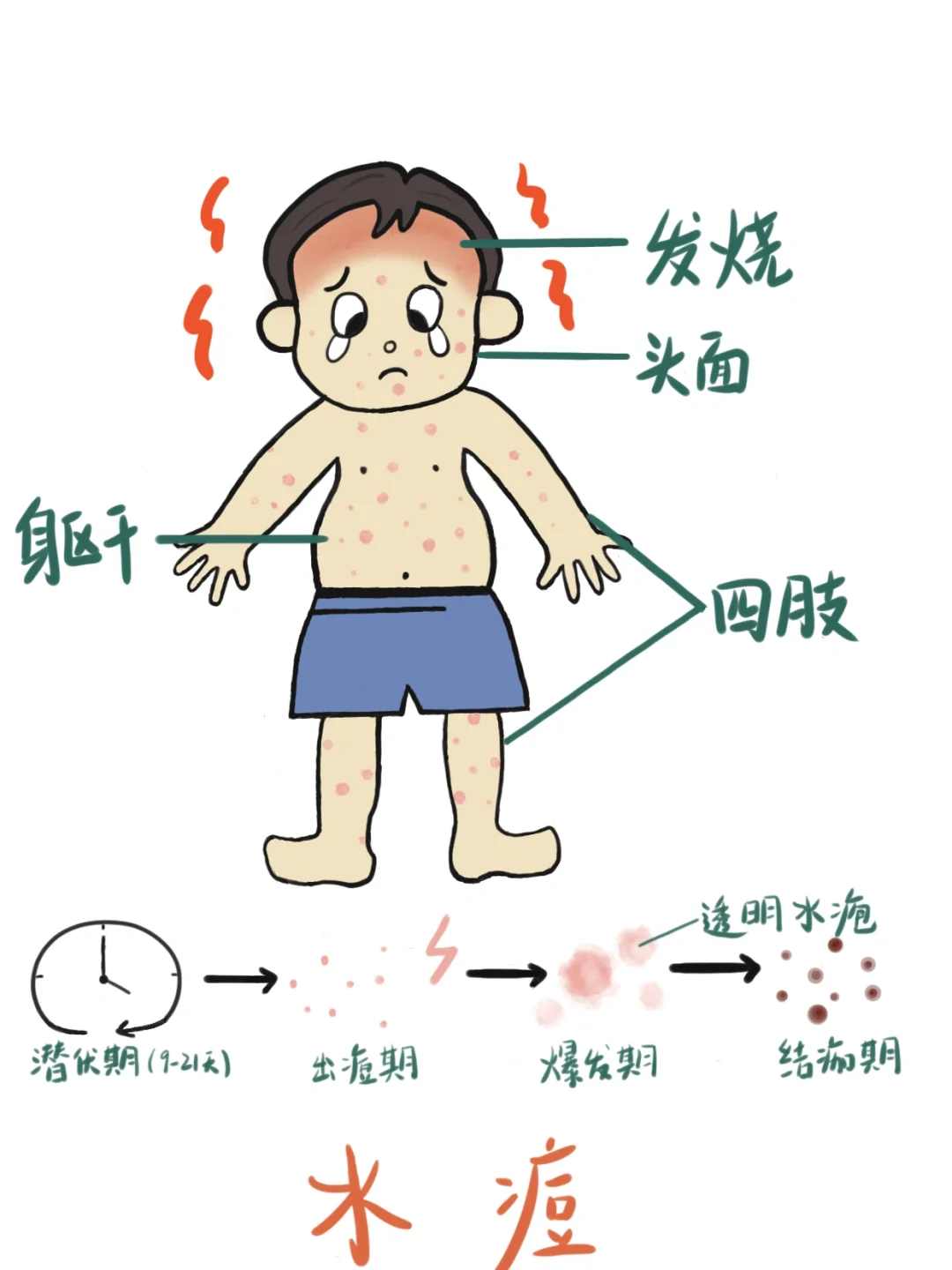 医学生笔记📒｜水痘🧐