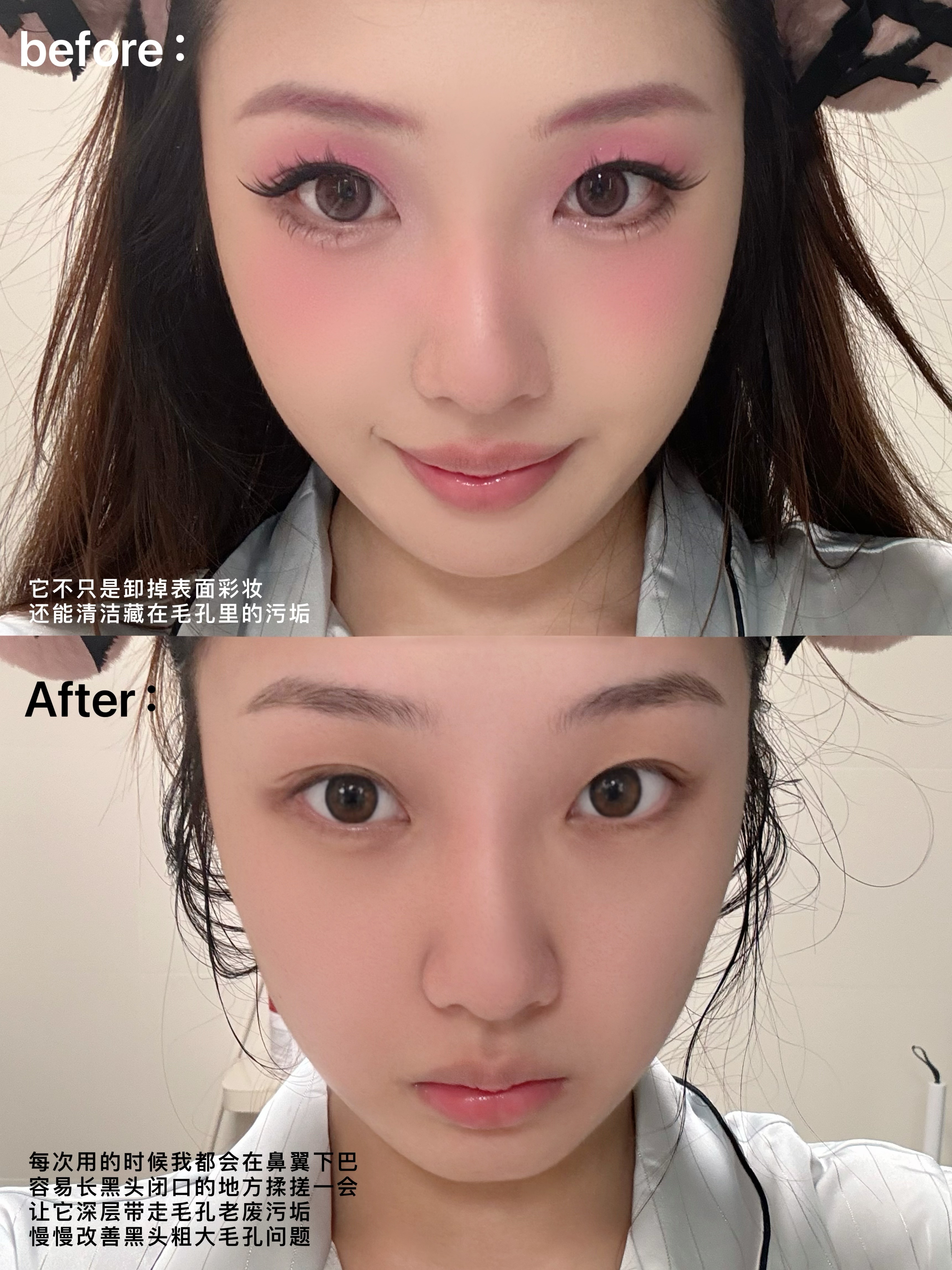 这瓶卸妆油感觉就是冲油痘肌来的！！！卸妆 说真的🤔，作为一个油痘肌，此前巨排斥