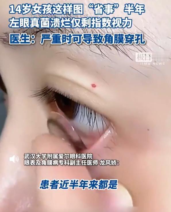 “太吓人了！”9月5日报道，湖北武汉，一14岁女孩喜欢带美瞳，而且她一旦戴上就长
