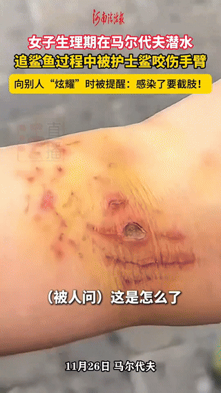 这女子是个狠人！马尔代夫一女子在生理期去玩潜水，不料，在水下和鲨鱼嬉戏过程中，被