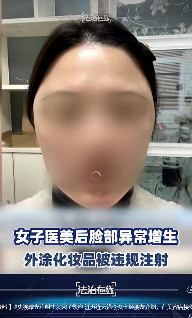 2026 年 8 月 30 日，据央视《法治在线》报道，近期一档调查节目揭开医美