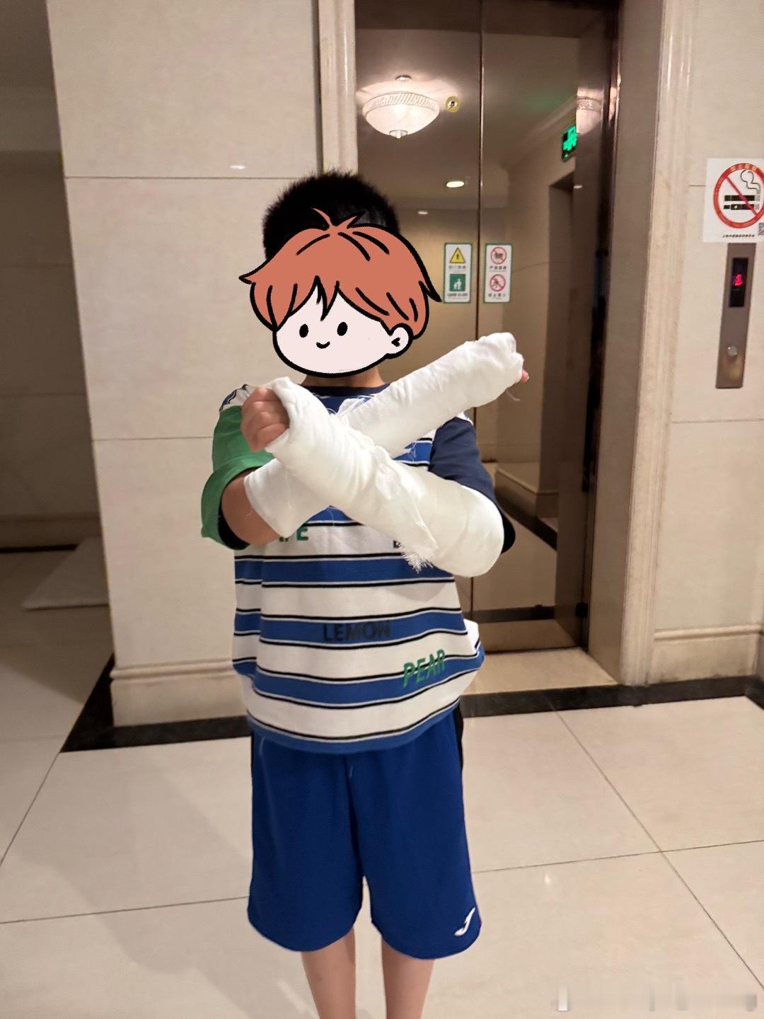 上周晚上，我们家小孩在和朋友戏耍的时候从高处跳下滑倒后用手臂一撑，结果双手骨折，