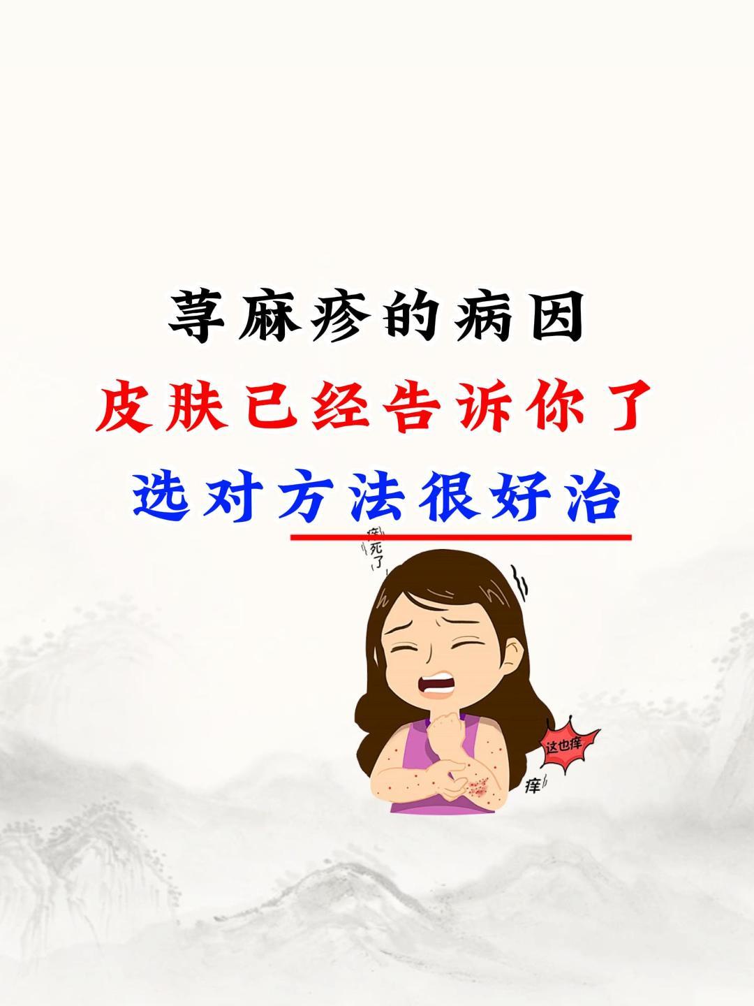 荨麻疹的病因，皮肤已经告诉你了，选对方法很好治。