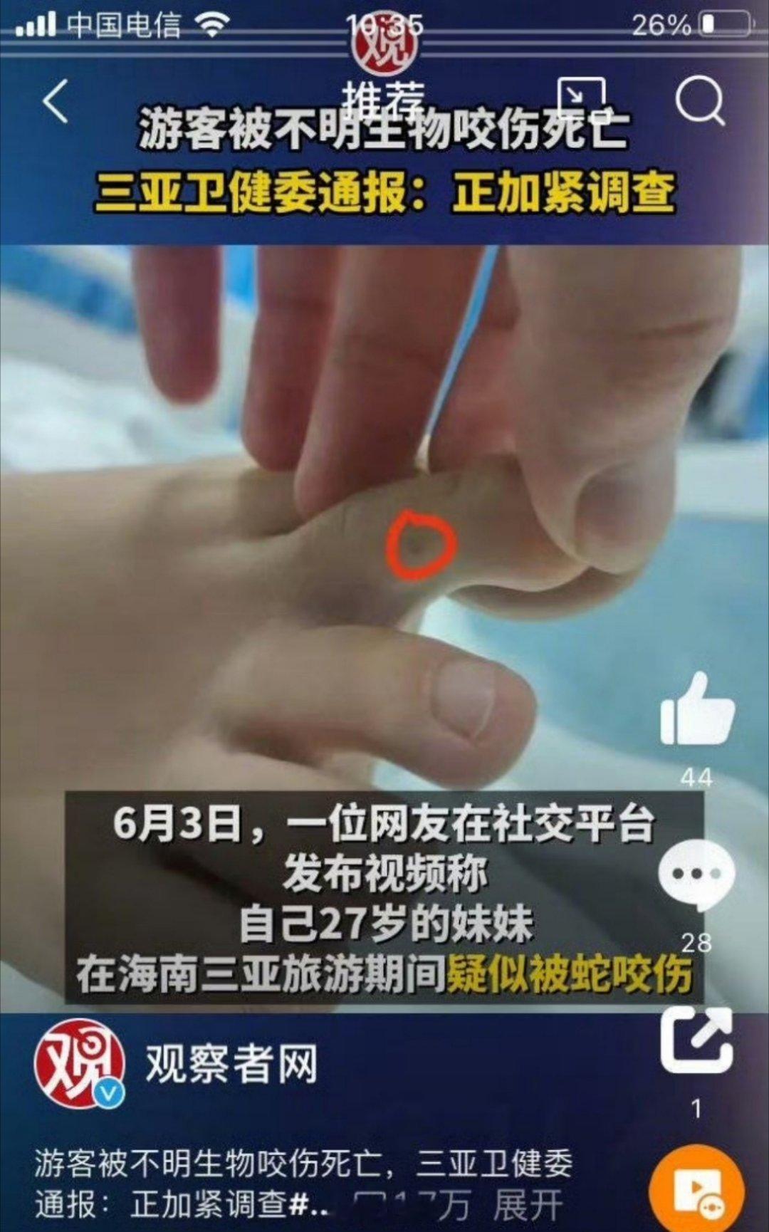 海南有74种蛇类毒蛇27种 媒体还在不断恐吓网友，听听这方面的医生怎么说的吧，更