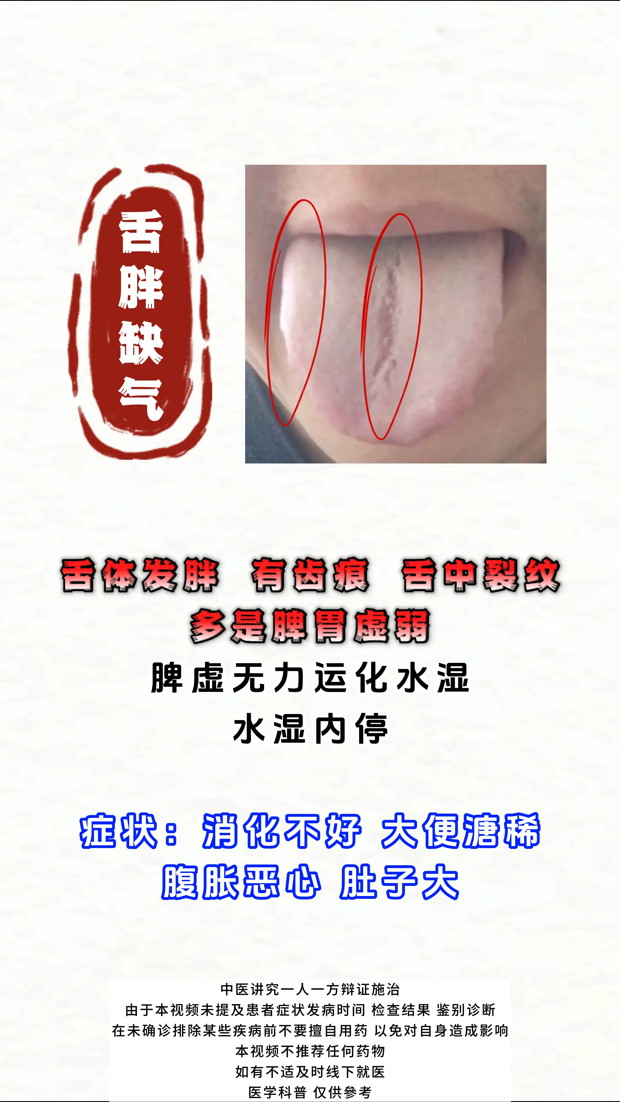 健康科普 舌象 中医科普 涨知识