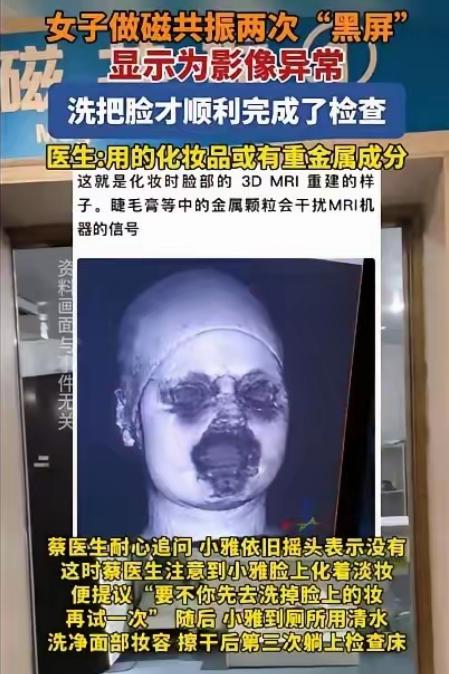 解释不清了！福建一29岁女生头晕，去医院做头颅磁共振。不料，连续2次扫描，都因面