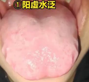 阳虚，怕冷？盲目补阳是不对的，阳气不足的3个阶段，对照看看 你是属于哪一种？

