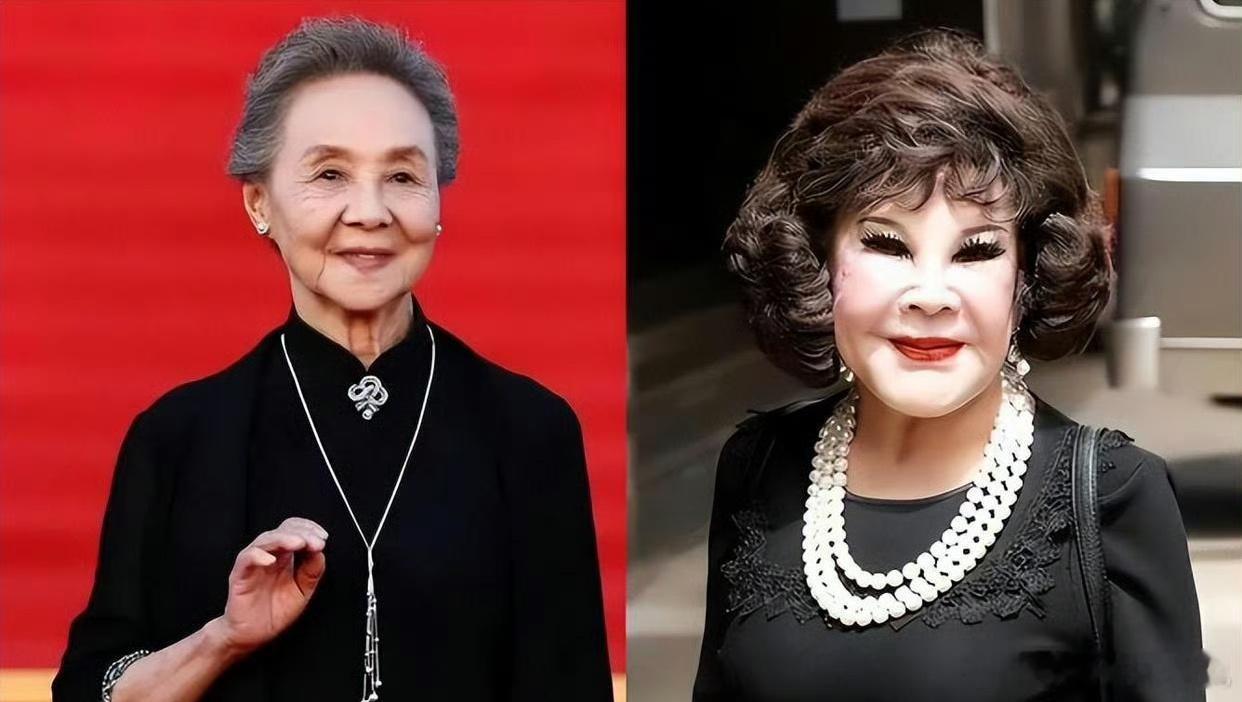 整容老去和自然老去，区别到底有多大，对比这一下就知道了 ​​​