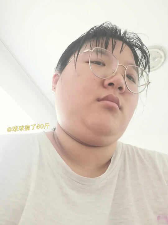 多囊，戒糖+降雄1年，get素颜杀伤力