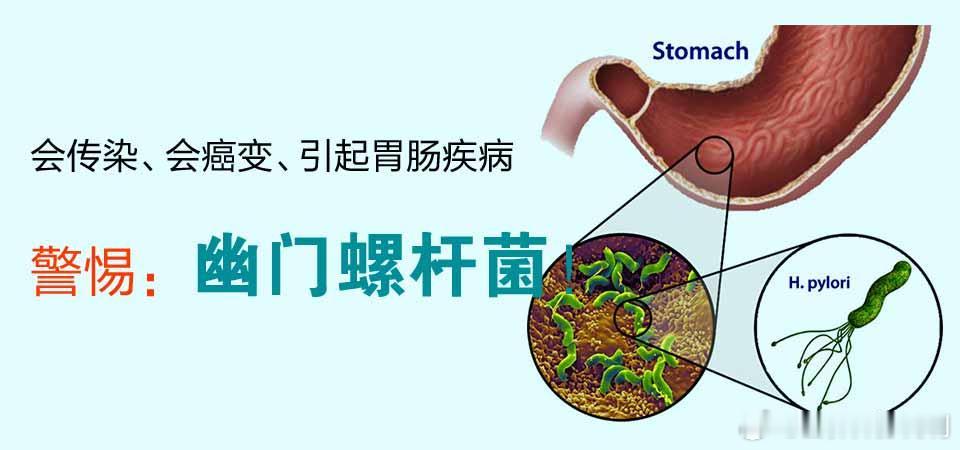 #健闻登顶计划##向肿瘤说拜拜##女性健康必修课# 【哪些人群需要进行幽门螺旋杆