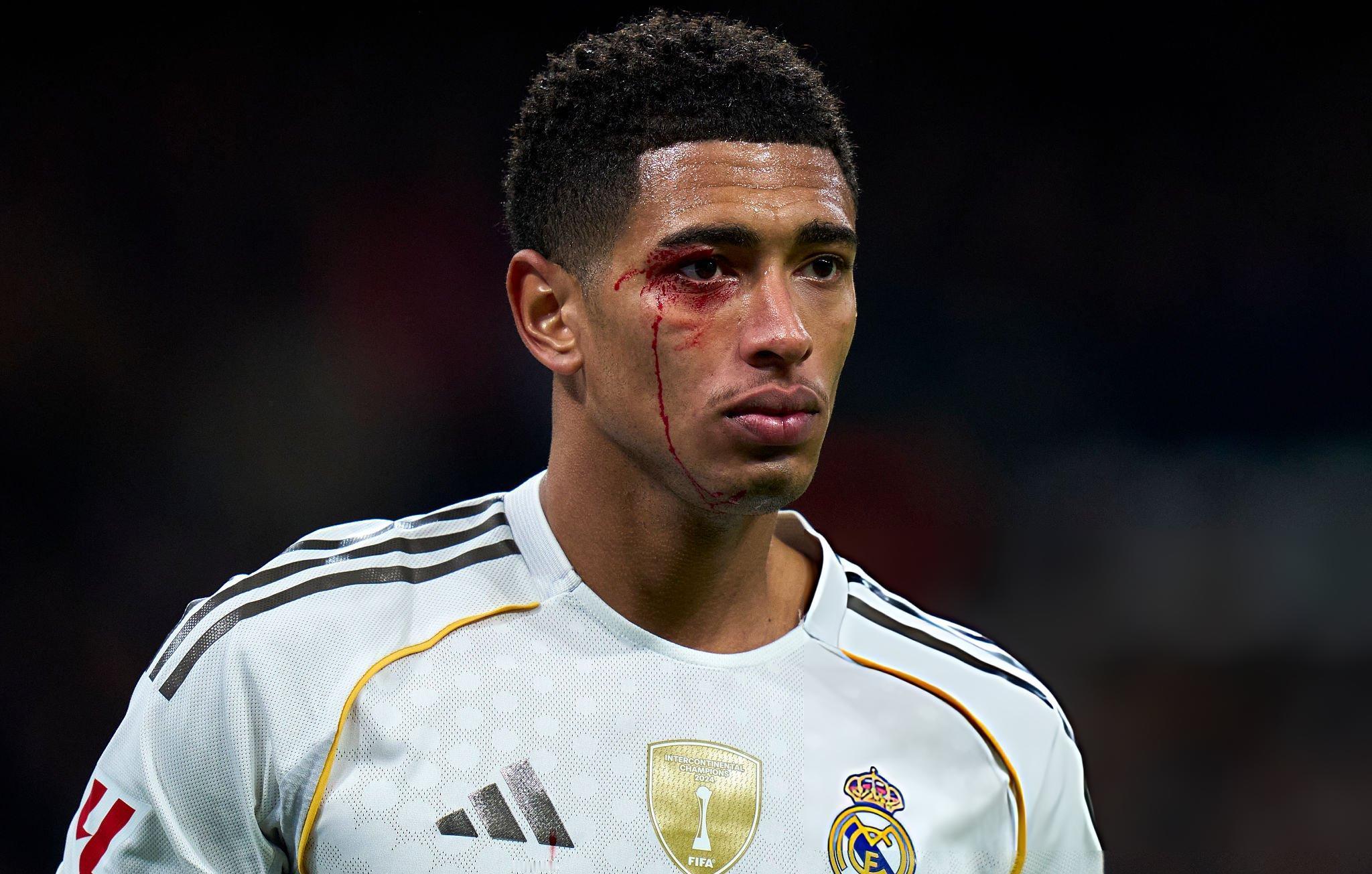 😞😞😞皇马vs塞尔塔